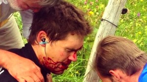 Bauer, tras su caída / PCS