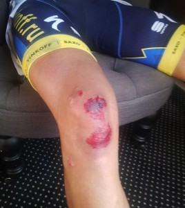 La rodilla del madrileño / Foto facebook Contador