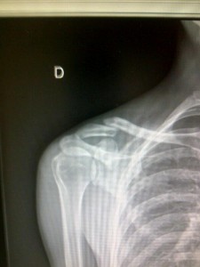 La fractura del australiano / Orica