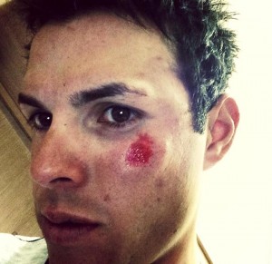 Lasca y su golpe © facebook