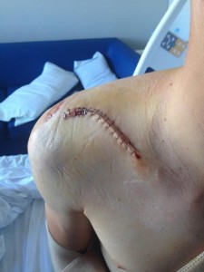 La cicatriz de la operación @ twitter