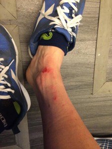 Así quedó el tobillo de Lobato.